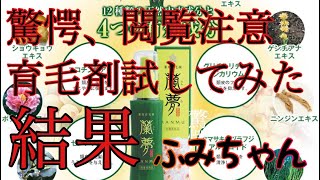 育毛剤チャレンジしてみた結果